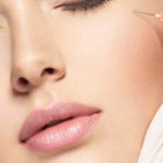 Dermal Fillers | Whites Dental