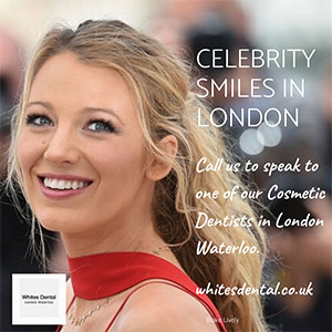 Hero image of Blake Lively highlighting the cometic dentistry services at Whites Dental.