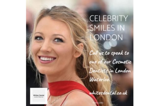 orthodontist london waterloo | Whites Dental