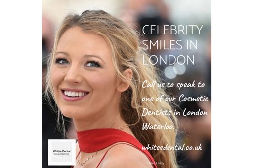 cosmetic dentist in london waterloo | Whites Dental