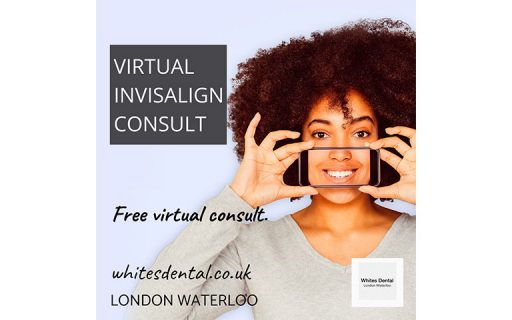 cosmetic dentist in london waterloo | Whites Dental