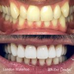 5 star reviews orthodontist london waterloo | Whites Dental