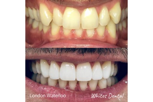 5 star reviews orthodontist london waterloo | Whites Dental