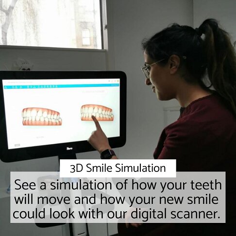 what is an orthodontist london | Whites Dental