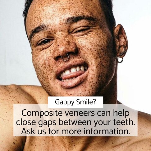 photo of man with freckles showing his 'gappy teeth'