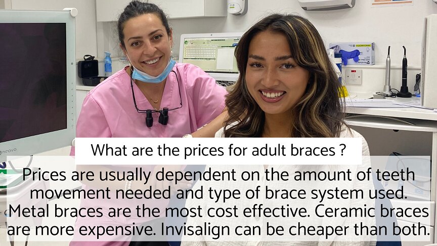 Adult Braces - FAQ - What are the prices for adult braces