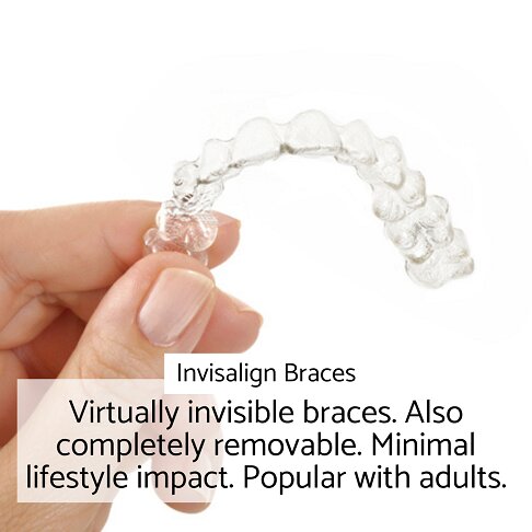 Adult Braces - Invisalign braces - virtually invisible