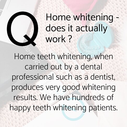 Teeth whitening Cost - frequently asked questions - Does home whitening actually work