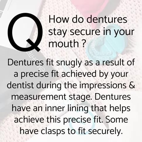 Dentures frequently asked questions FAQ - how do dentures stay secure in your mouth