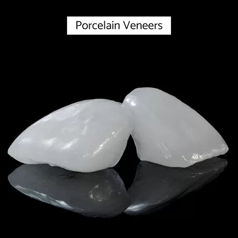 Porcelain Veneers In London - Regular Porcelain