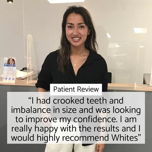 Whites Dental London - Fees - Porcelain Veneers Review