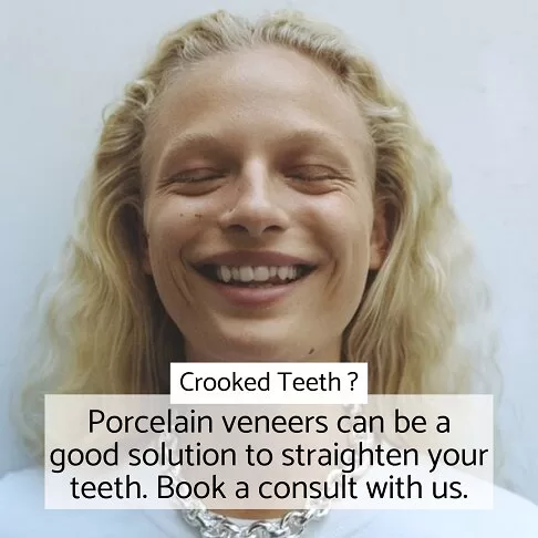 Cosmetic Dentist London - Crooked Teeth Corrected With Porcelain Veneers