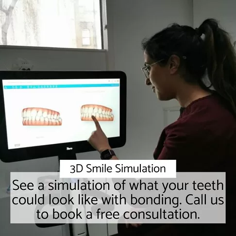 Cosmetic Dentist London - Smile Simulation