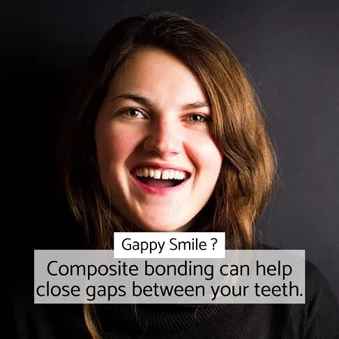 Woman with a gap in her teeth, promoting composite bonding solutions for gap closure at Dentist Paddington